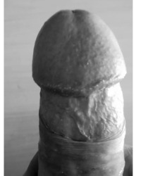 photo-thumb