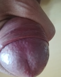 photo-thumb