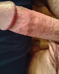 photo-thumb