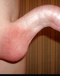 photo-thumb