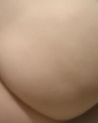 photo-thumb