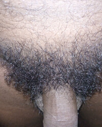 photo-thumb