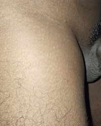 photo-thumb