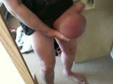 Thumb 1