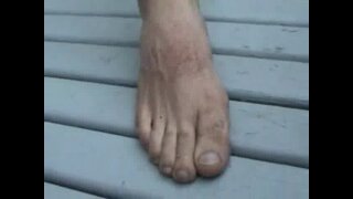 Thumb 1