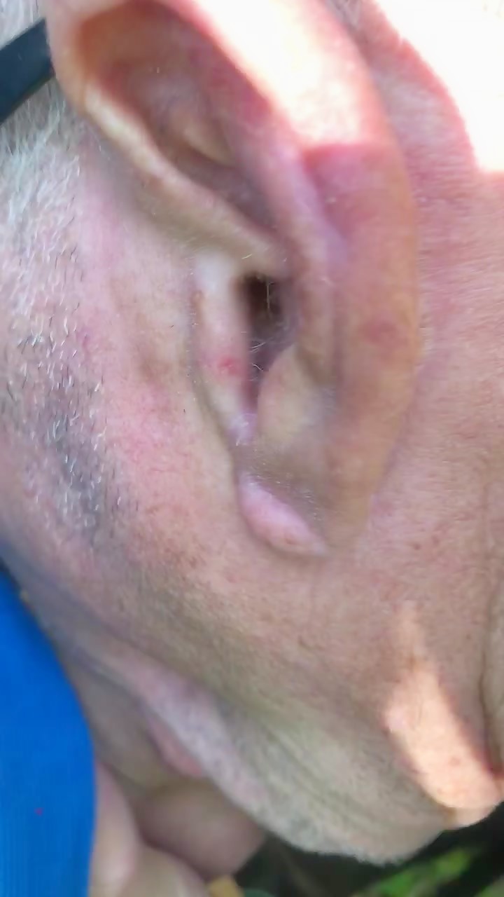Thumb 9