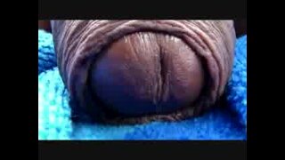 Thumb 10