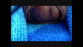 Thumb 9