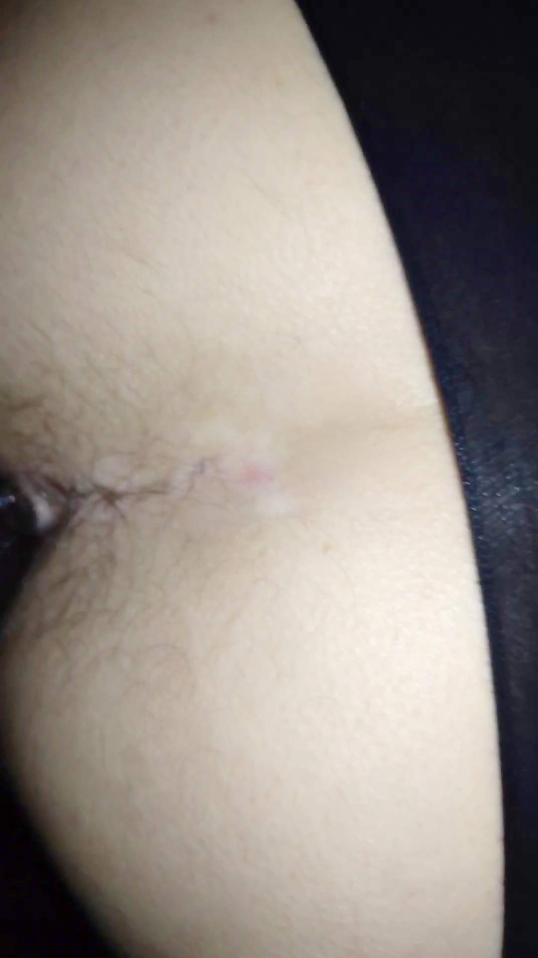 Thumb 13