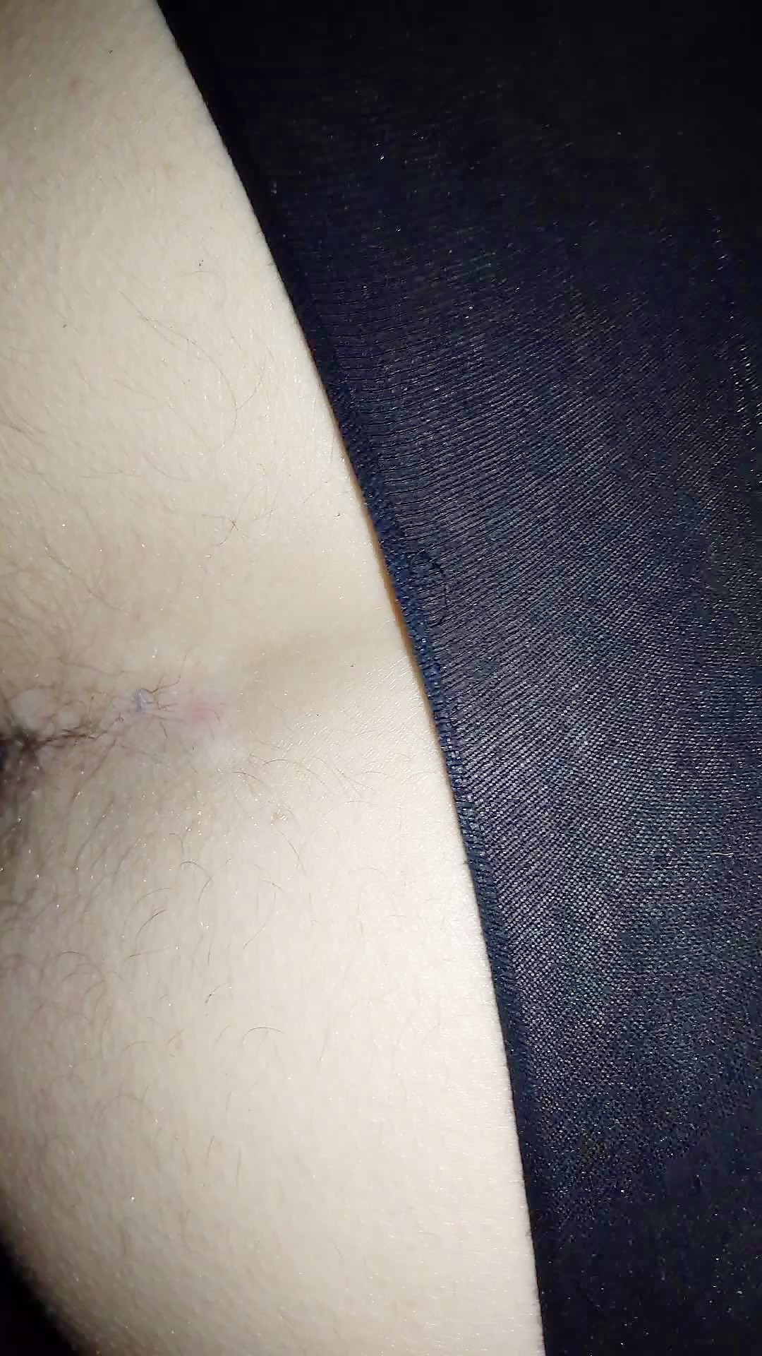 Thumb 14