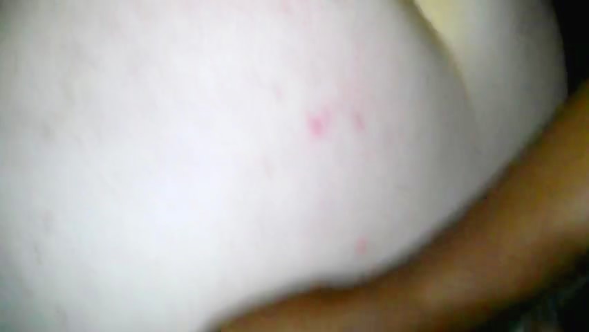 Thumb 8