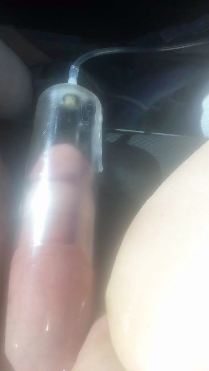 Thumb 1