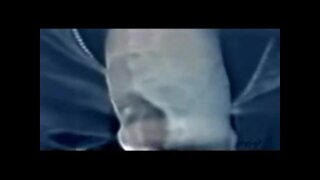 Thumb 1