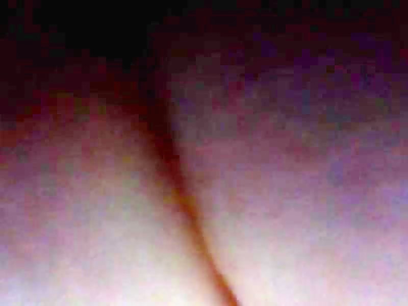 Thumb 20