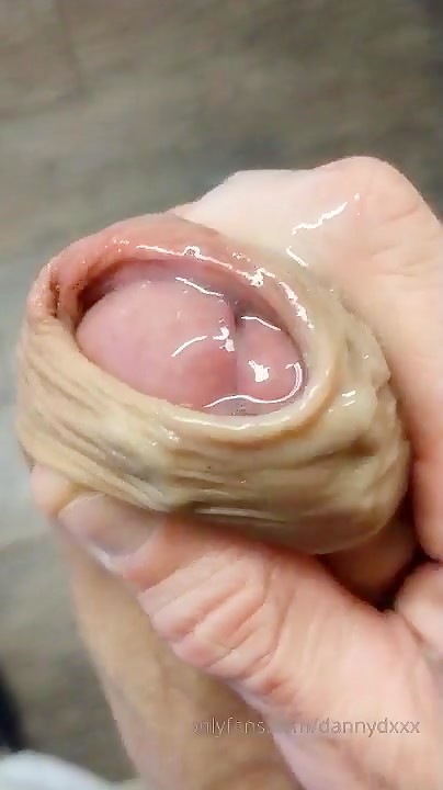 Thumb 20