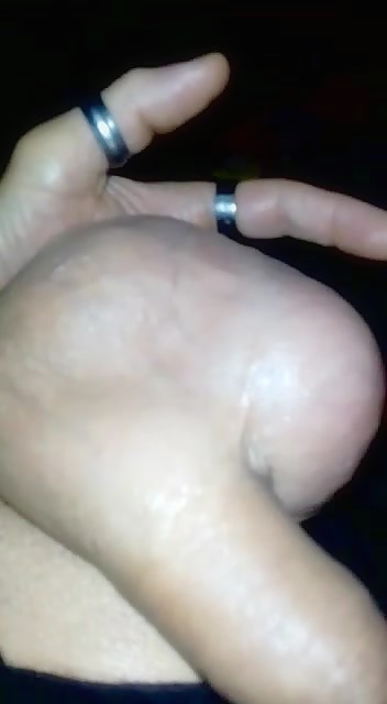 Thumb 7