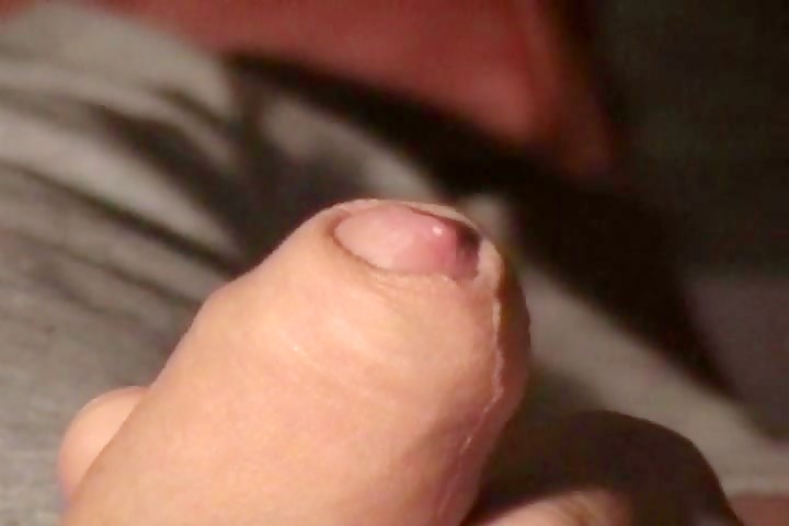 Thumb 9