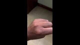 Thumb 1
