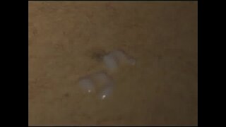 Thumb 10